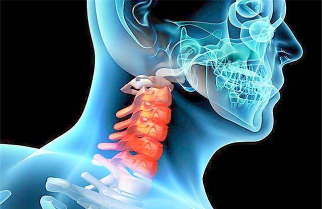 颈椎问题引发头晕，深度解析与应对方案