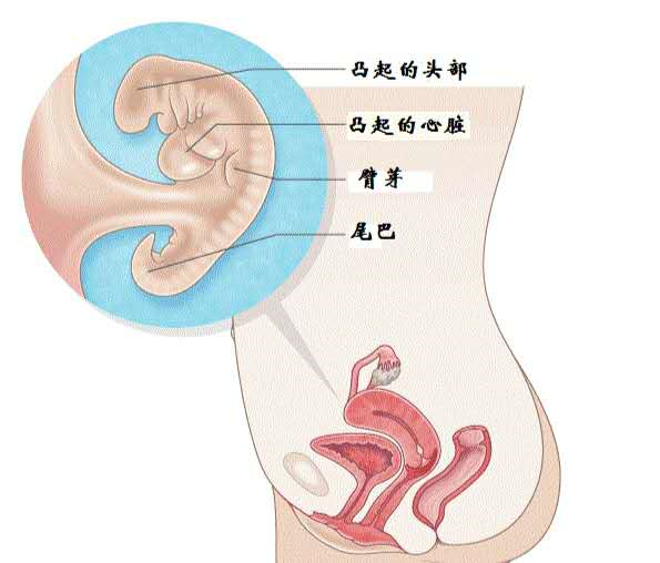 三个月婴儿心脏杂音，早期关注与理解