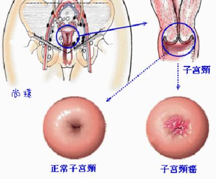 广东省子宫癌医院，专业治疗与全方位的关怀